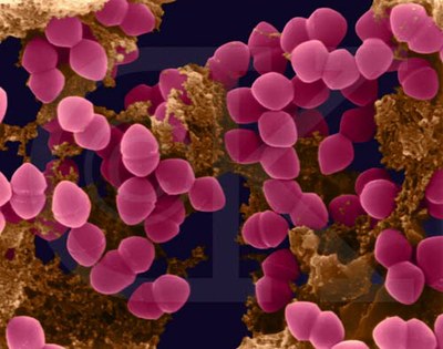 enterococci.jpg