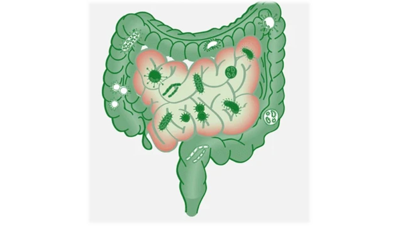 Role of sulfidogenic bacteria in human disease2