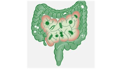 Role of sulfidogenic bacteria in human disease2