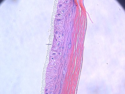 reconstructed_skin
