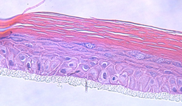 reconstructed skin
