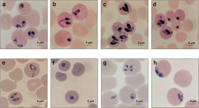 Bbovis_erythrocytes.jpg