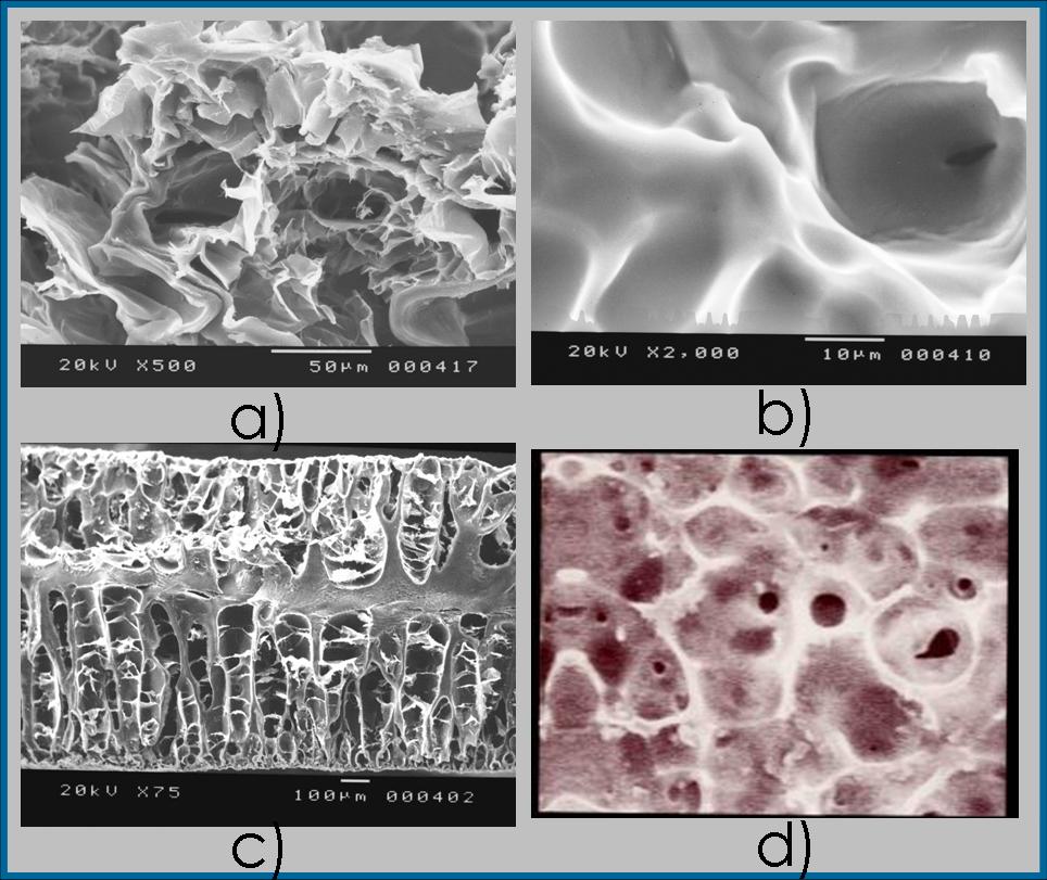 SEM photograph of dried gels