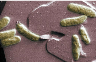 shewanella