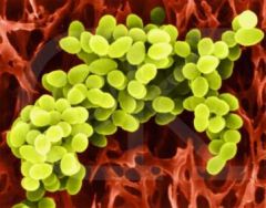 Lactococcus lactis.jpg