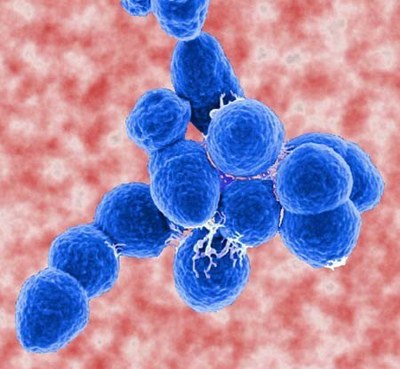 Streptococcus%20pneumoniae.jpg