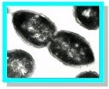 Research_Molec_Epidem_Pneumococci.jpg