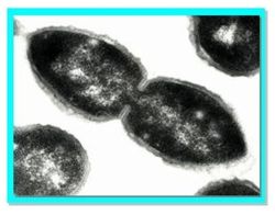 Research_Molec_Epidemio_Pneumococci_Fig0A.jpg