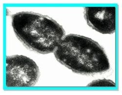 Research_Molec_Epidemio_Pneumococci_Fig0A.jpg