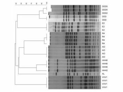 Research_Molec_Epidemio_Pneumococci_Fig2B.jpg