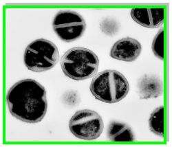Research_Molec_Epidemio_Staphylococci_Fig0A.jpg