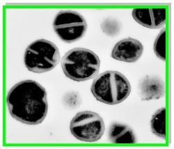 Research_Molec_Epidemio_Staphylococci_Fig0A.jpg