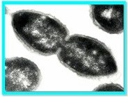 pneumococci.jpg