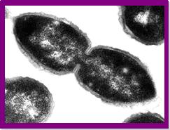 pneumococci 1.JPG