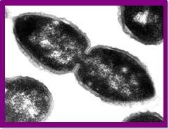pneumococci 1.JPG