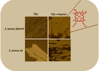 Trichomonas 1