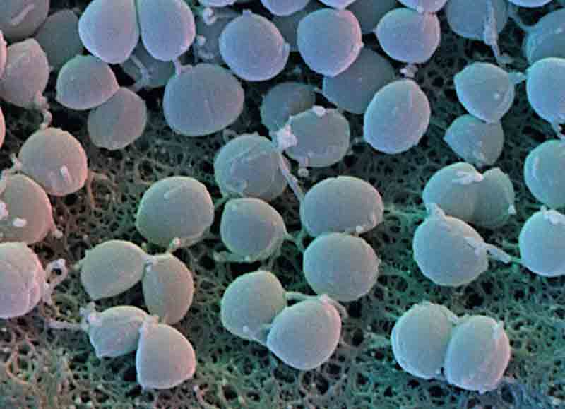 staph.-aureus.jpg