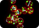 Breaking Symmetry: how spherical bacteria organize their DNA for survival