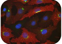 Glycosylation in ovarian carcinoma cells