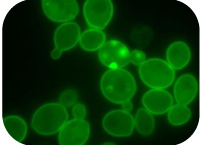 Heat resistant microorganisms and Parkinson’s disease