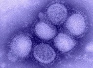 Notes on Influenza A (H1N1)2009
