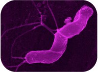 Novel bacterial strategy to cope with host defenses uncovered