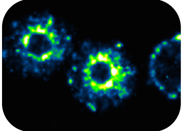 Super-Resolution Microscopy in Infection and Immunity 